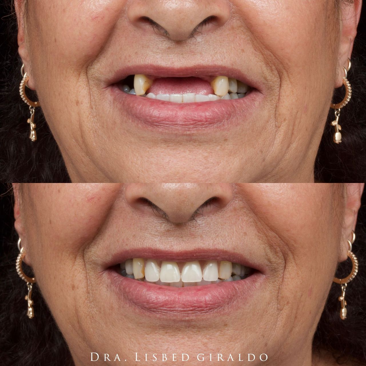 Lisbed Giraldo Olarte-6