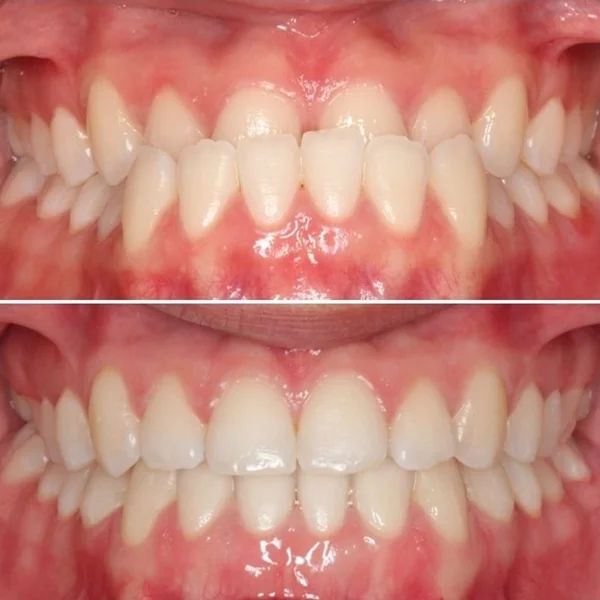 Frank Mendoza Alanya-33