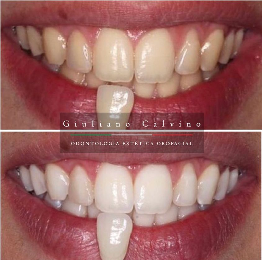 Giuliano  Calvino-14