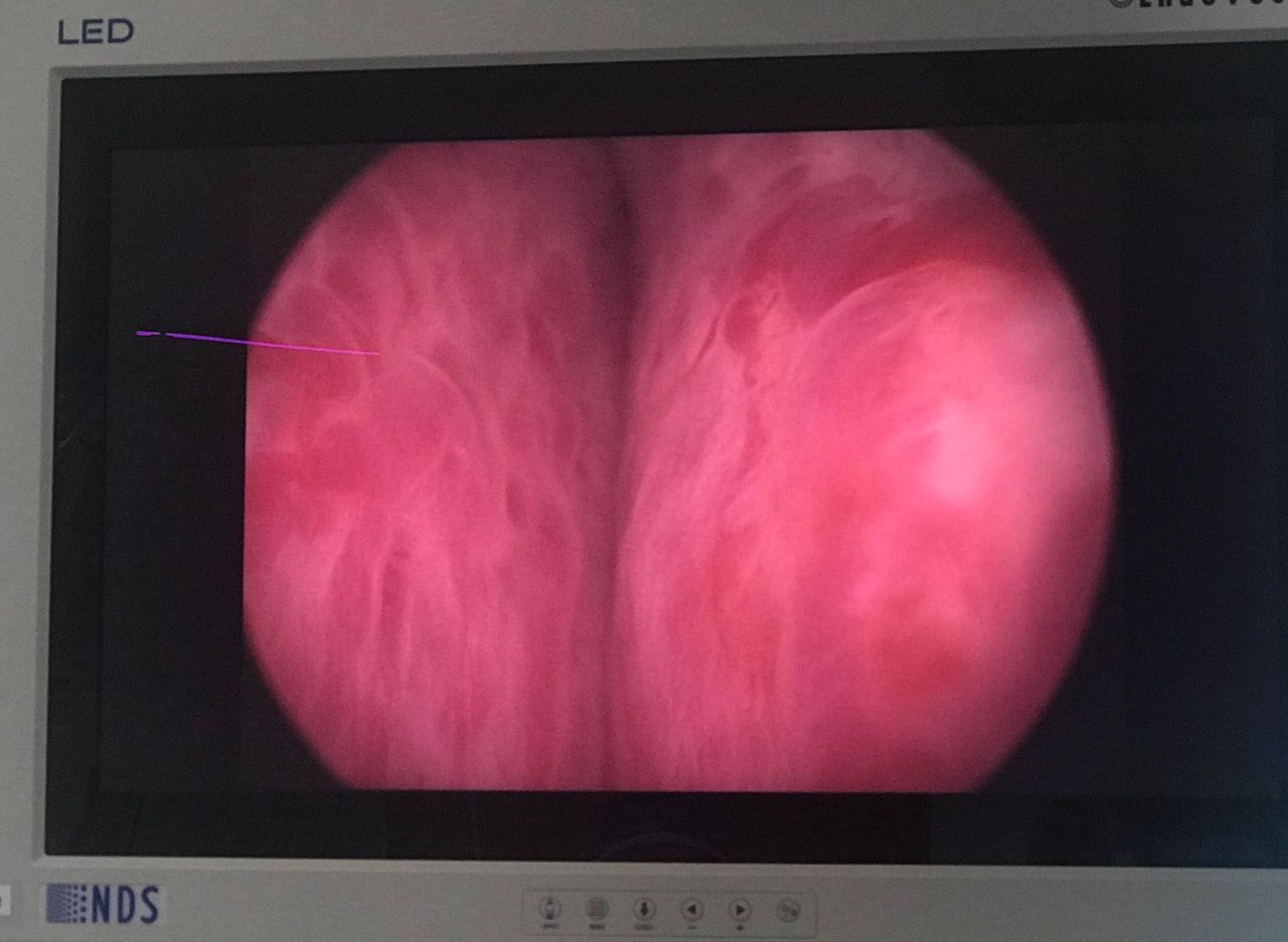 Juan Guillermo Velásquez López-17