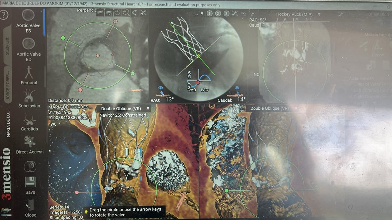 Leonardo Da Cruz Nunes-2