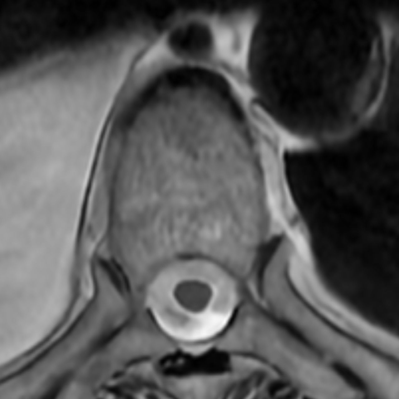 David Tafur Muñoz-2047