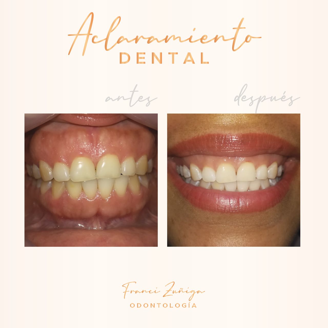 Francia Elena Zuñiga-4