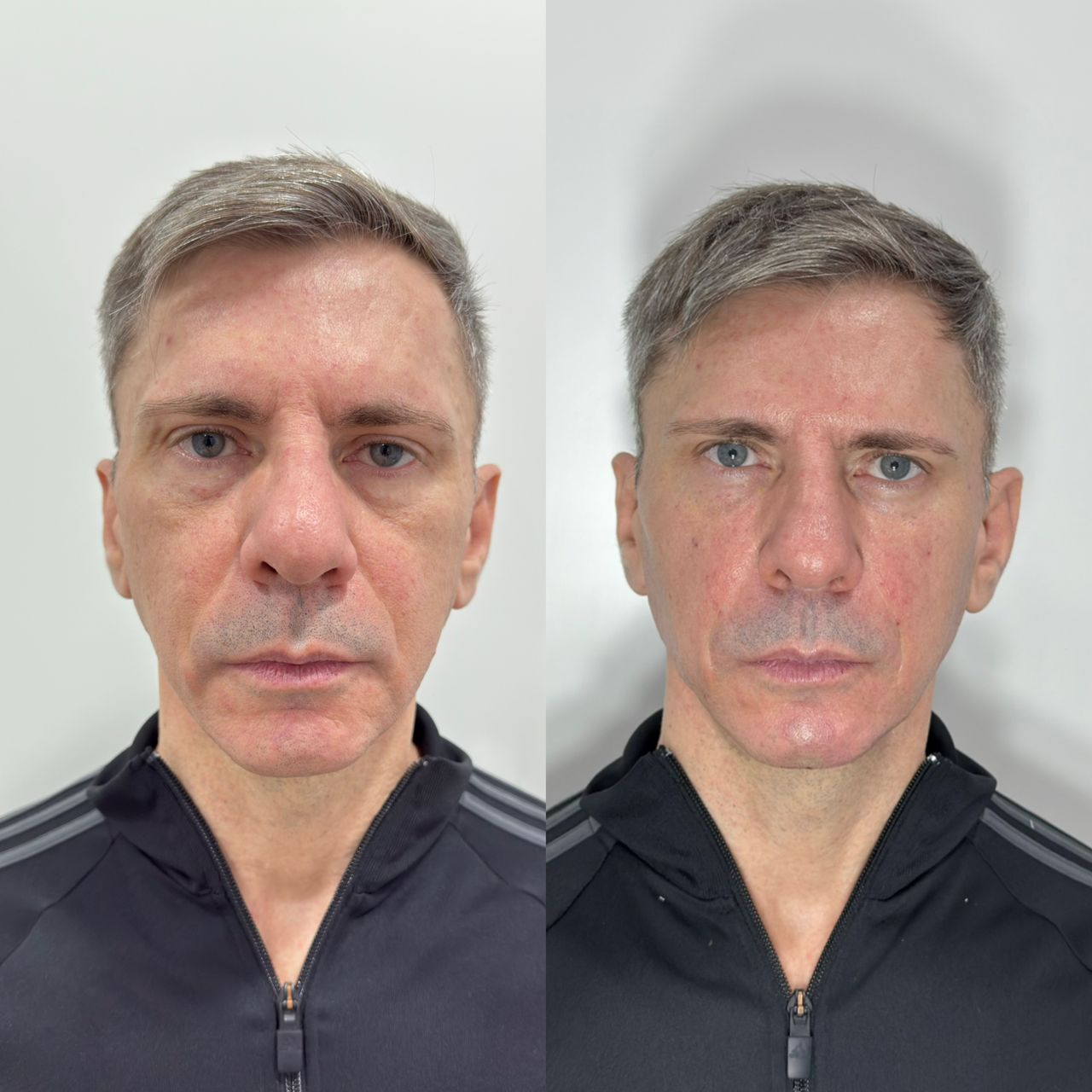 Caroline Benedeti-51