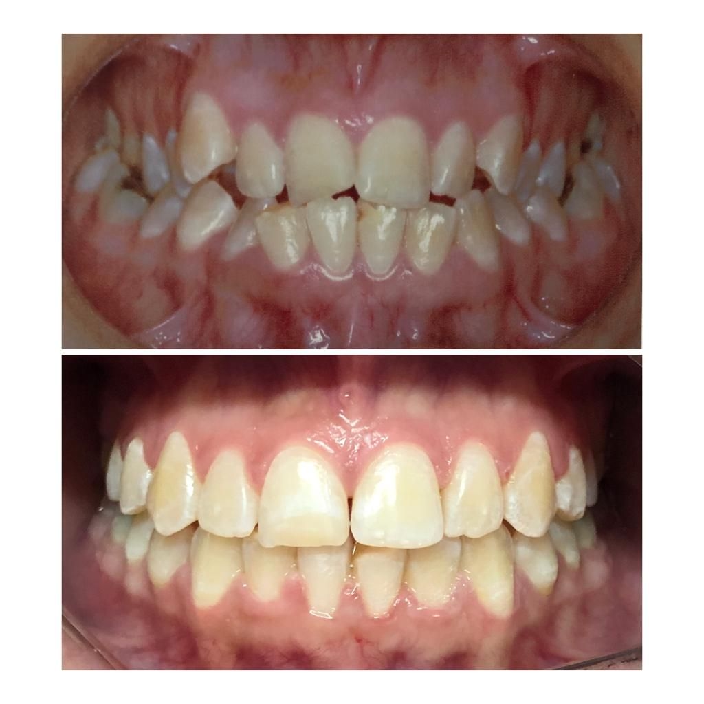 Noara Taline Pereira Dos Reis-3