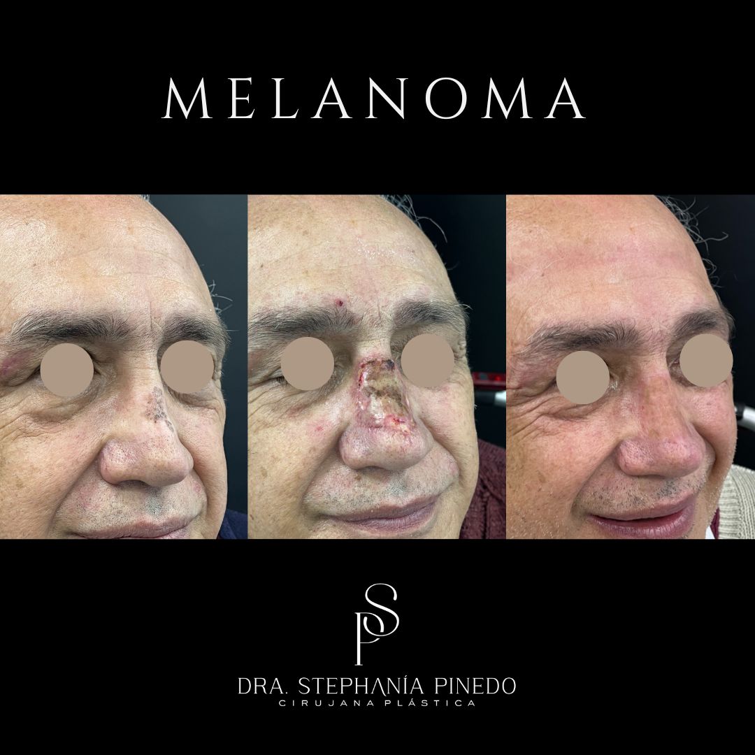 Stephanía Pinedo García-10