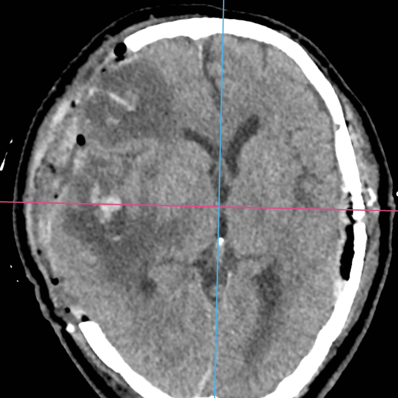 David Tafur Muñoz-2354