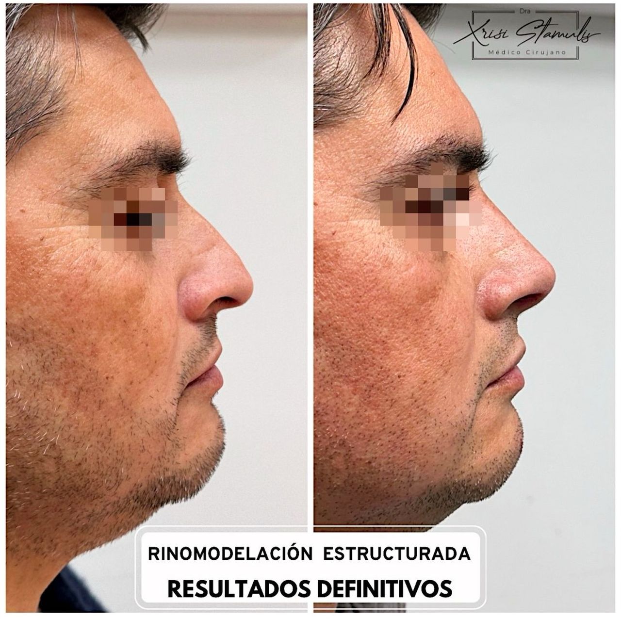 Xrisi Stamulis Rivera-4