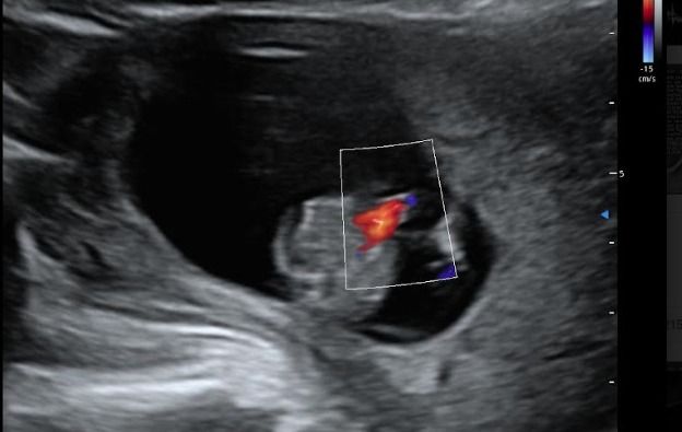 Cesar Vicente Albornoz Moreira-11