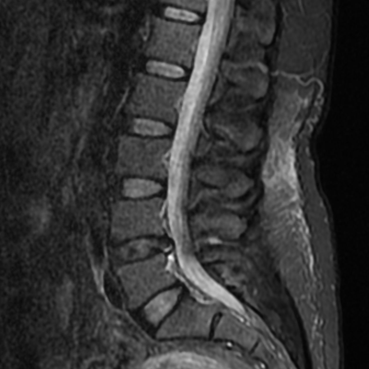 David Tafur Muñoz-1593