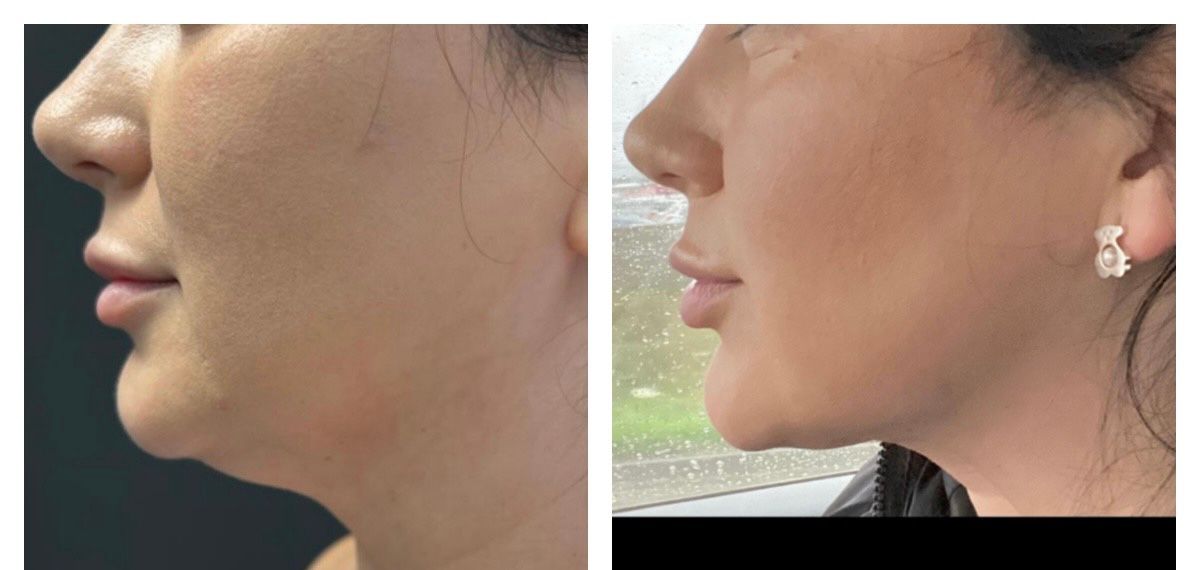 Fernando Oviedo Monsalve-0