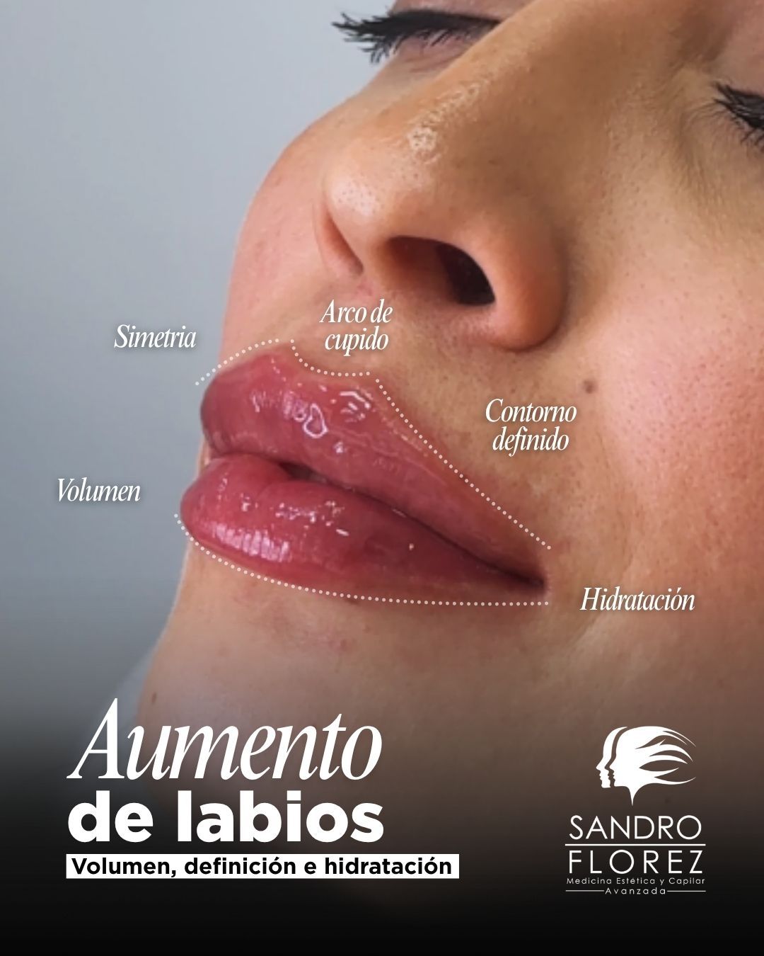 Sandro Florez-19
