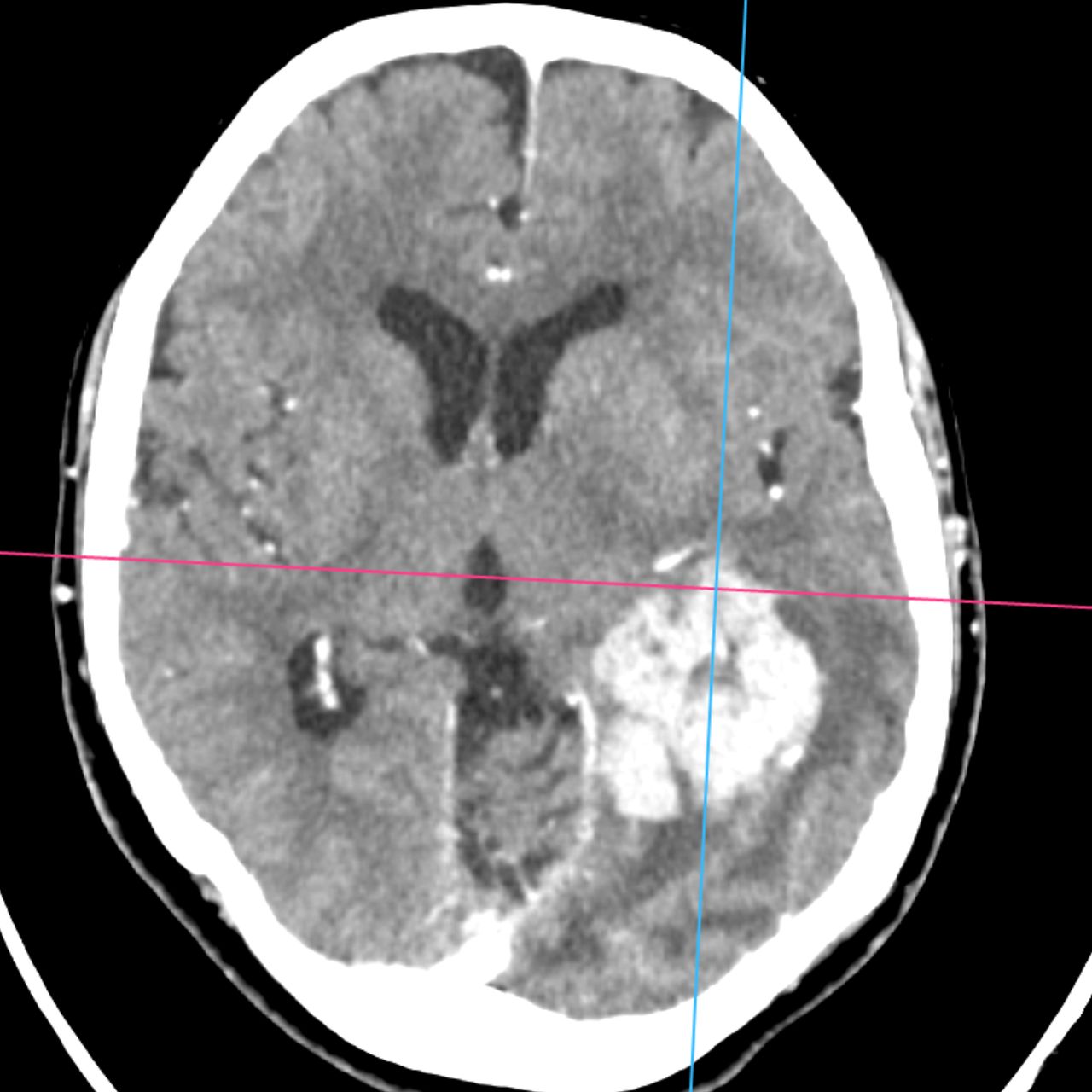 David Tafur Muñoz-1746