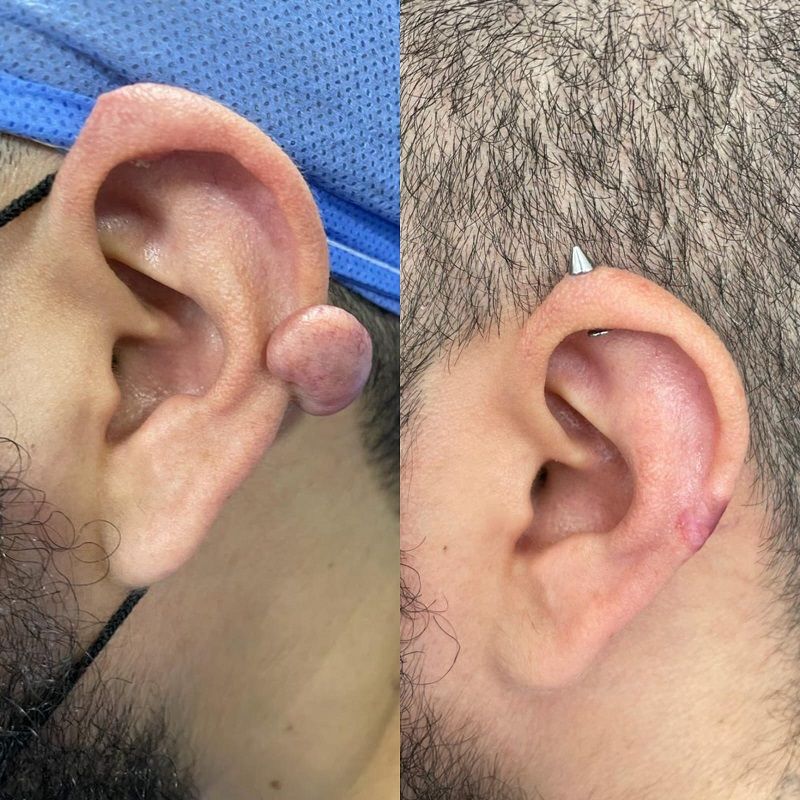 Ana Lucia Rave Martinez-11