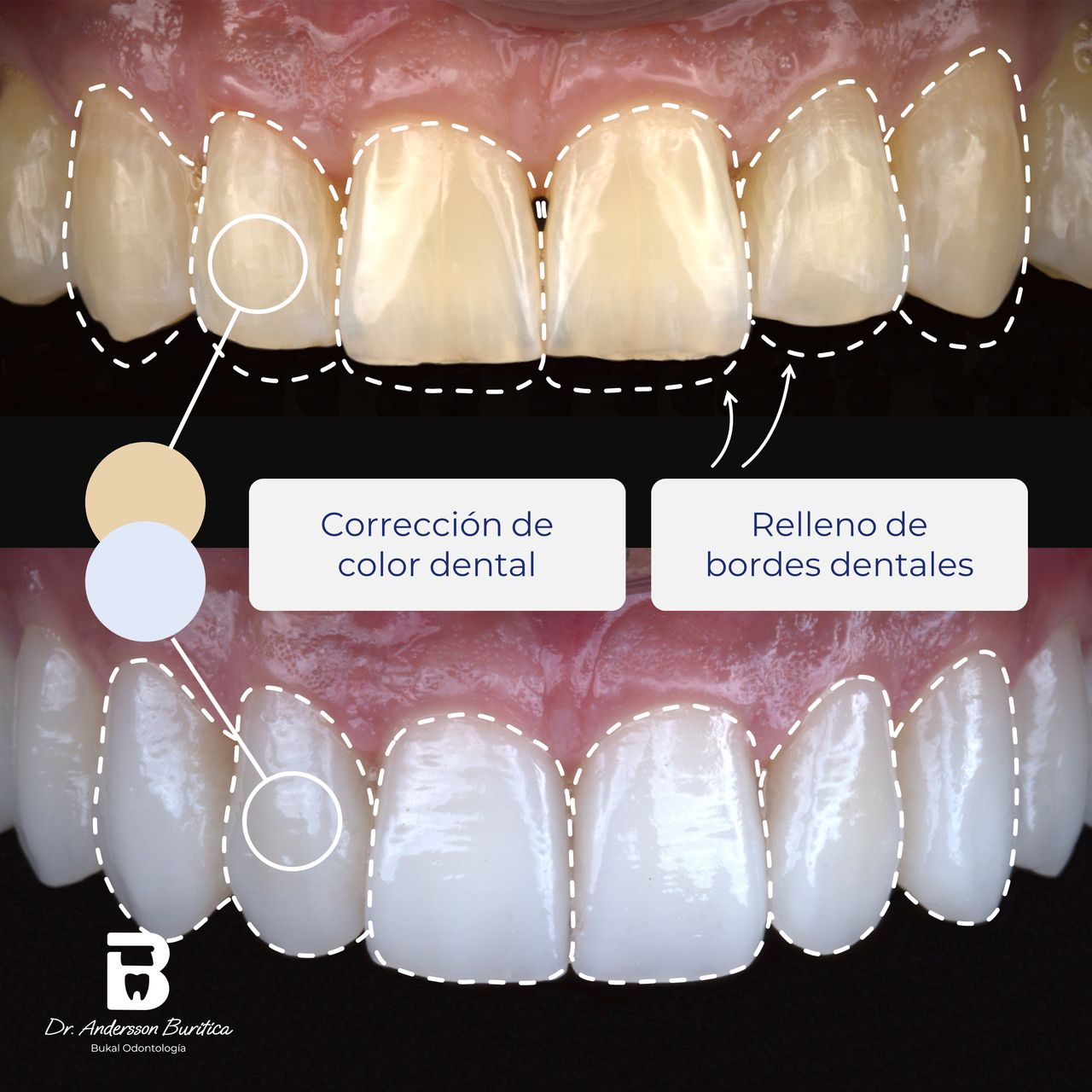Andersson Buritica-9