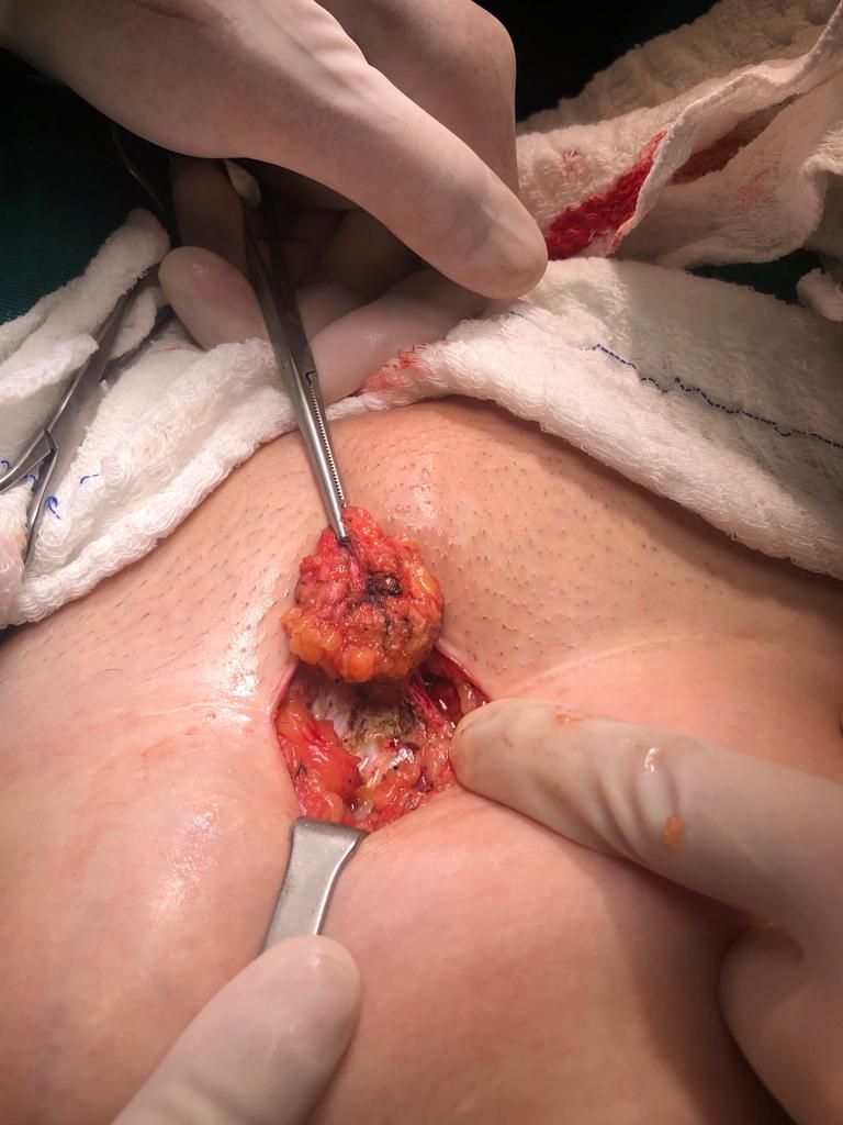 Adalberto Cesario Pereira Junior-37