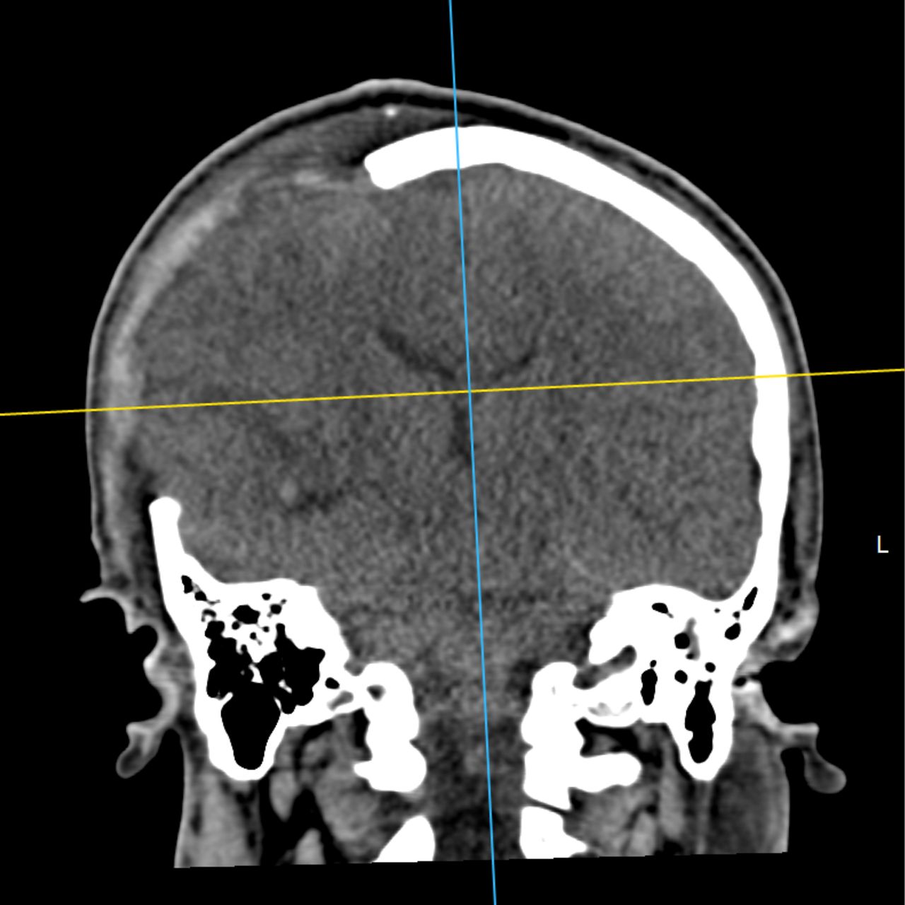 David Tafur Muñoz-1814