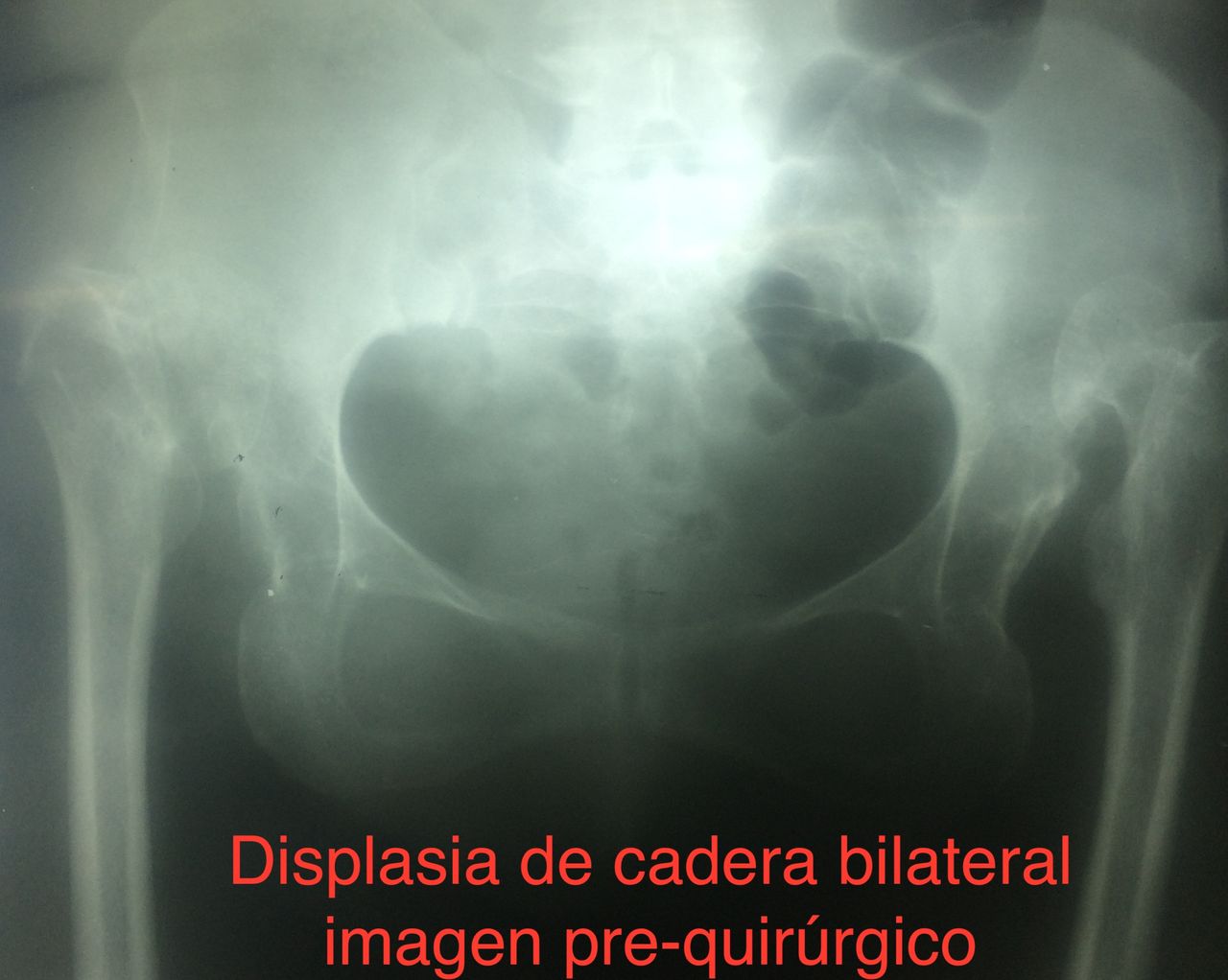 Manuel Carlos Suyon Paniccia-7