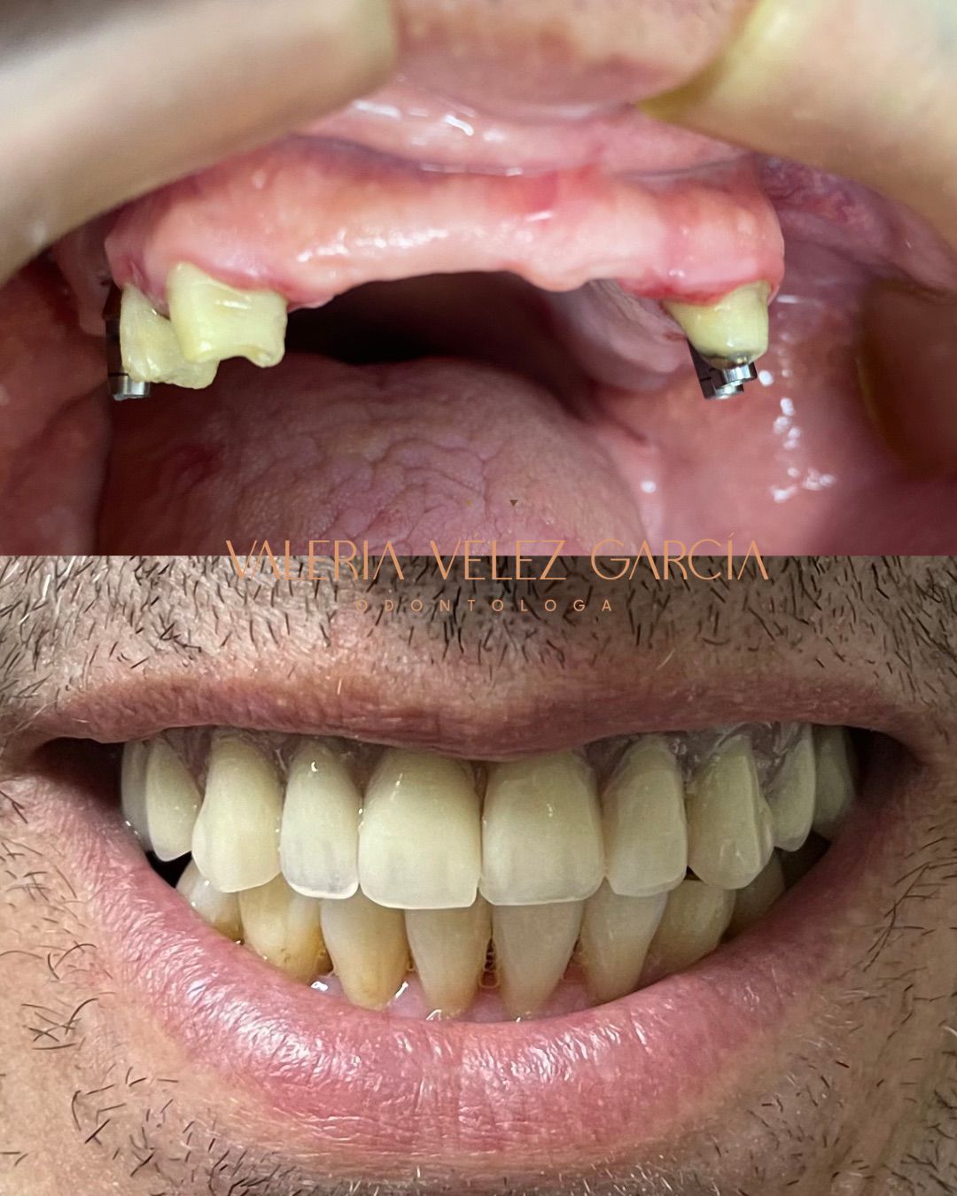 Valeria Vélez García-6