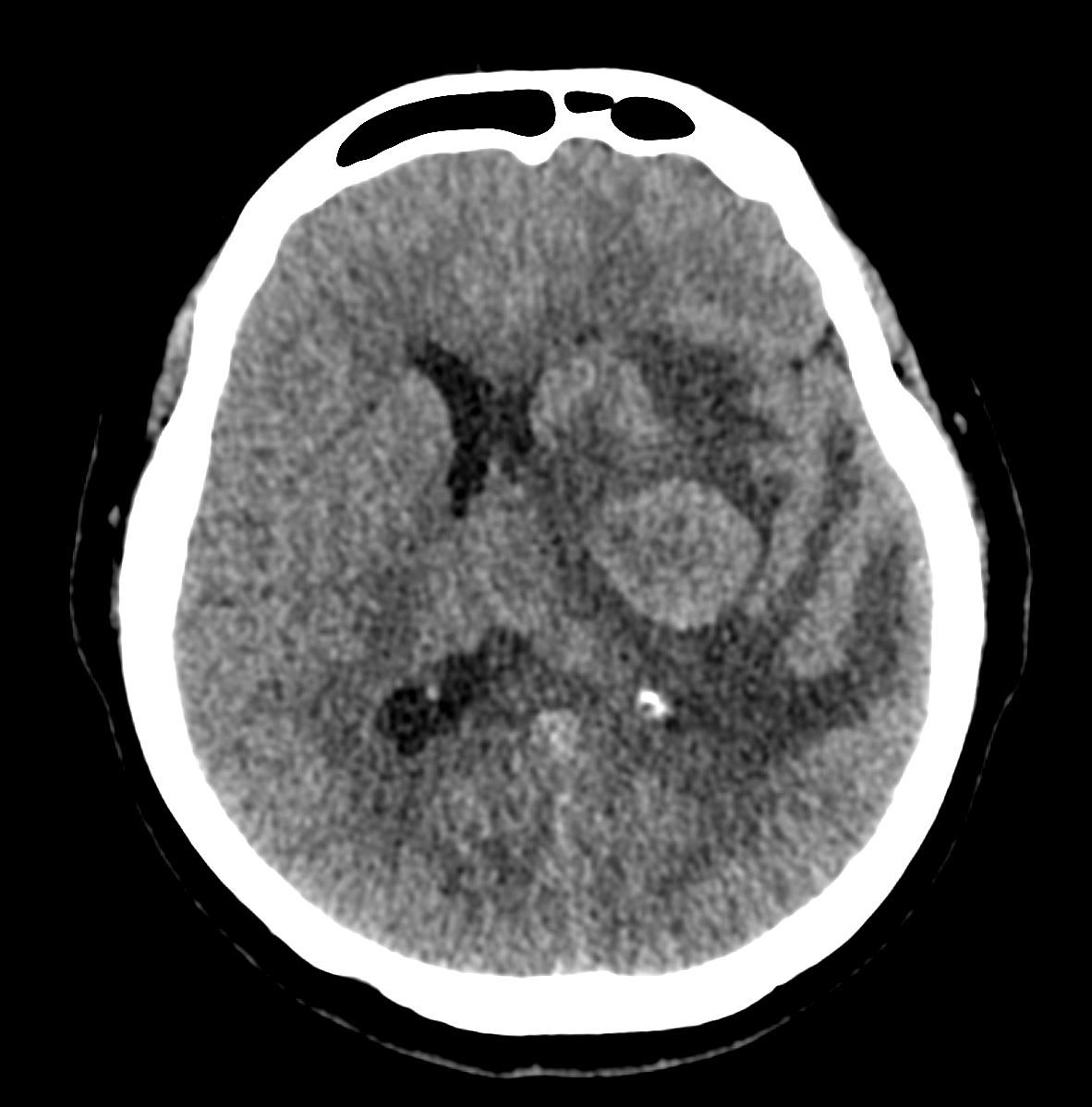 David Tafur Muñoz-1076