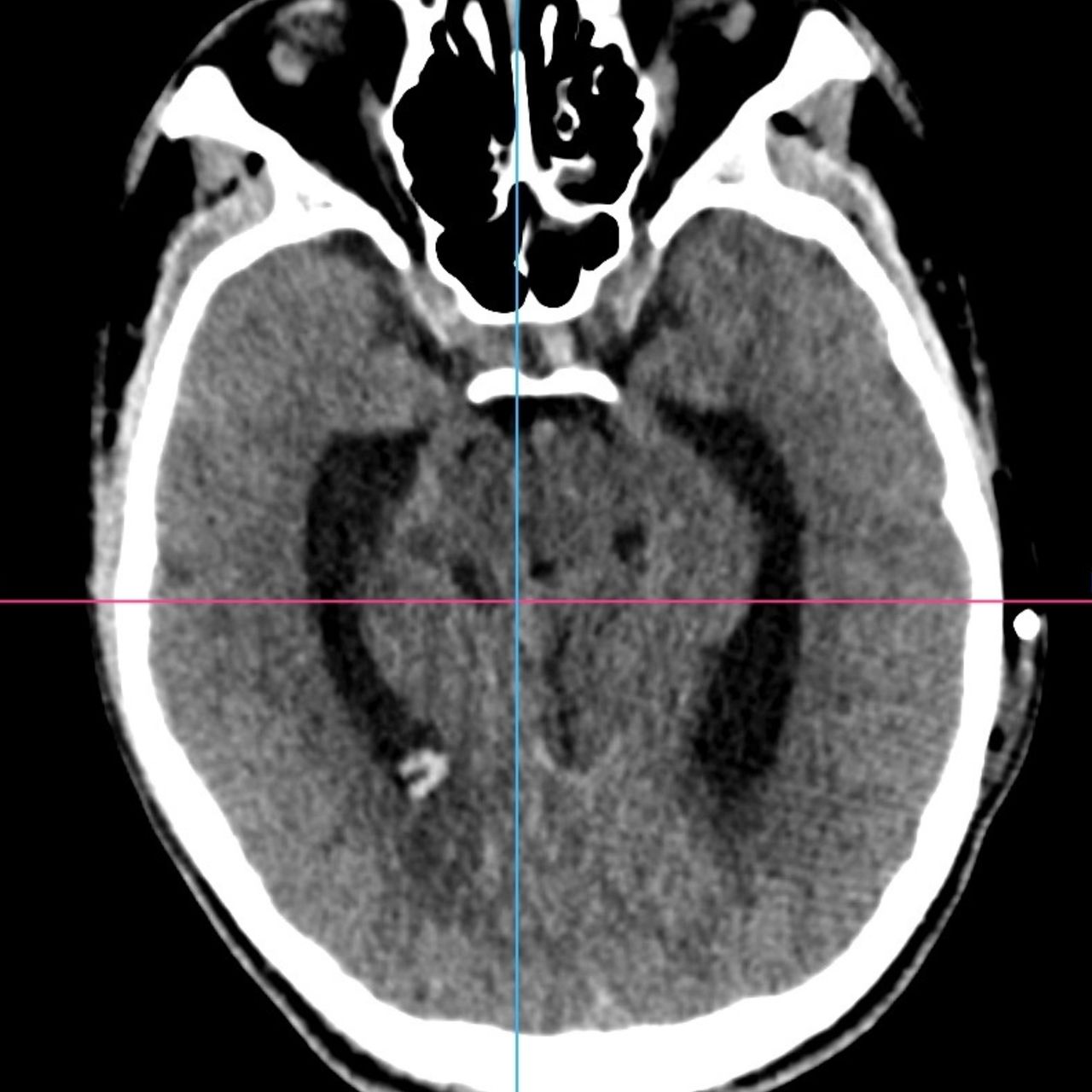 David Tafur Muñoz-1482