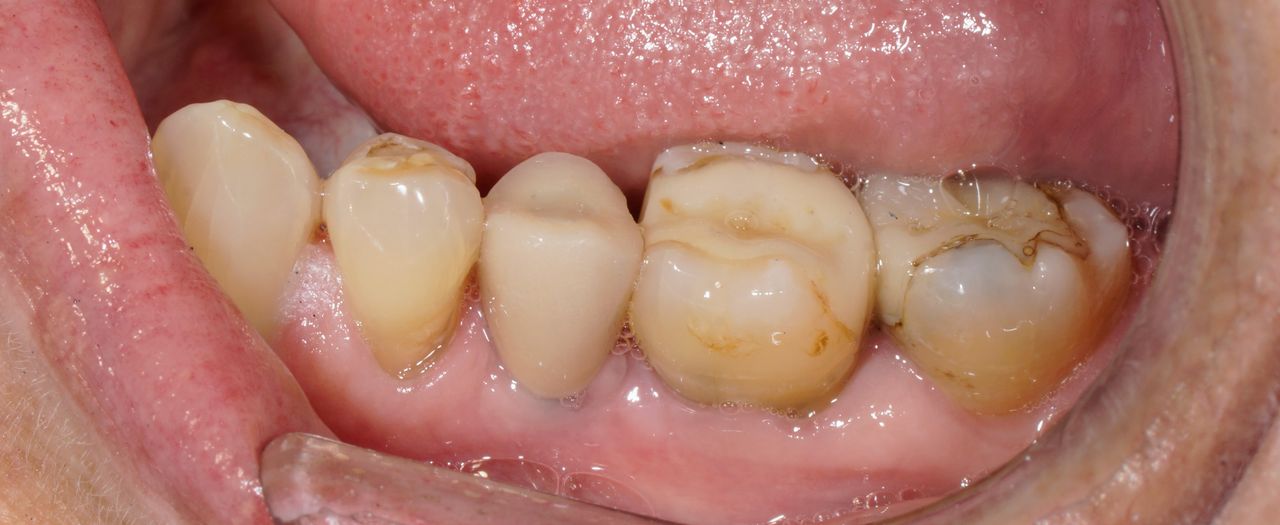 Hernán Andrés Febre Moscoso-20