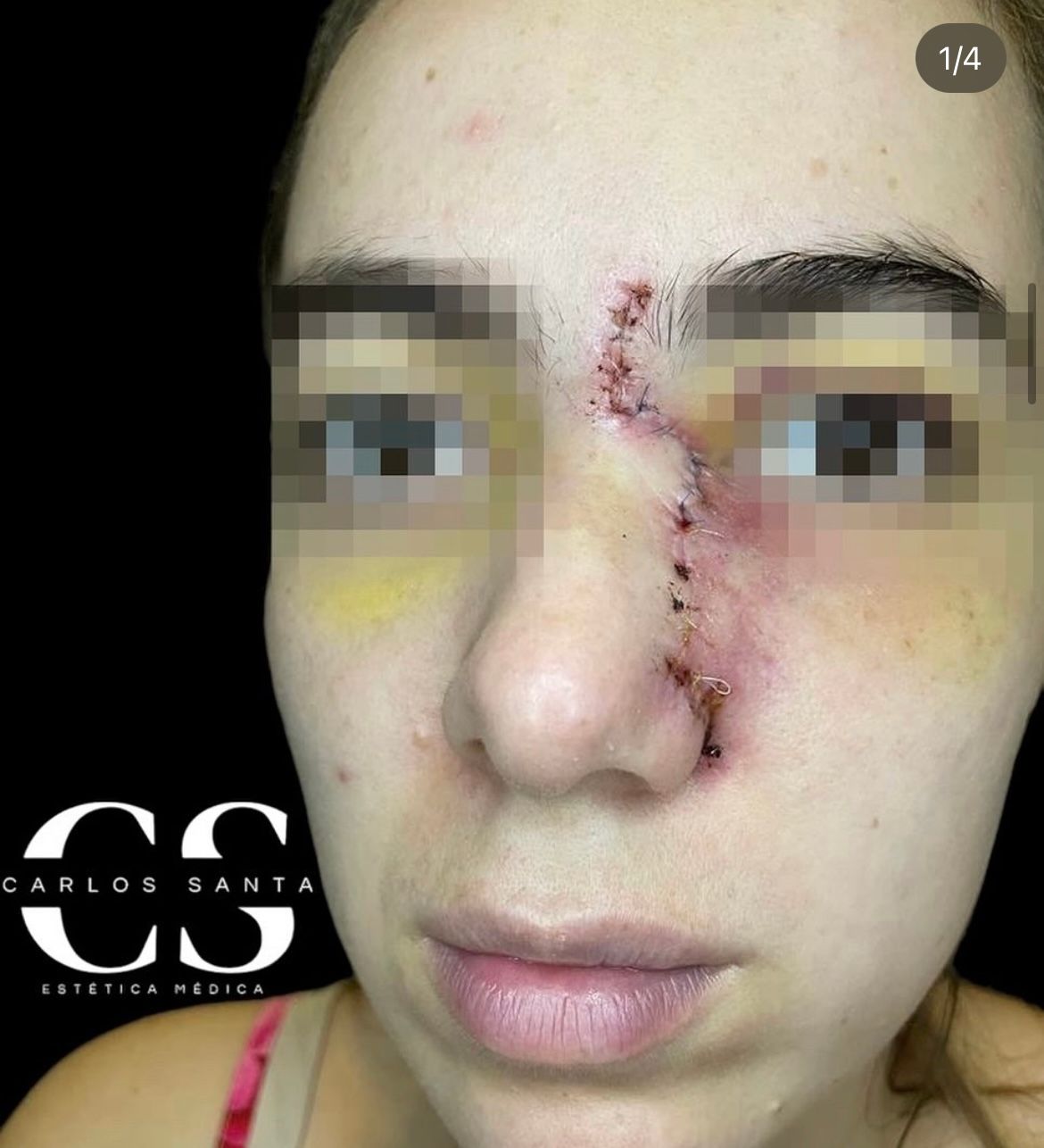 Carlos Andrés Santa-16