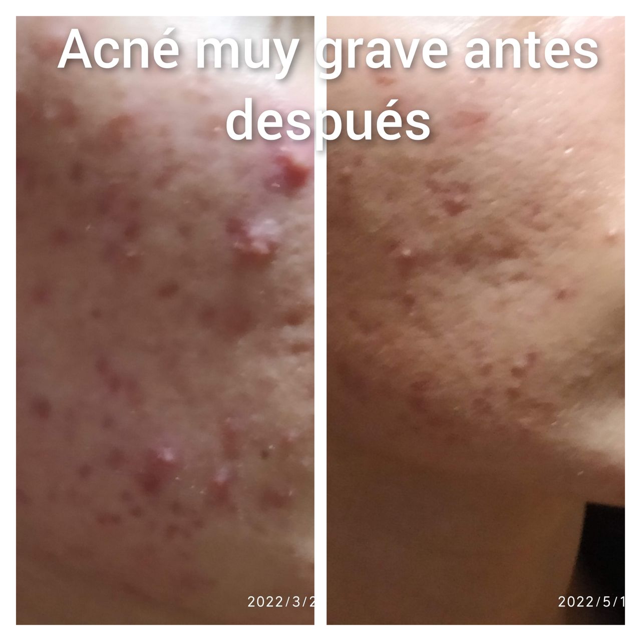 Alejandra Meijide-17