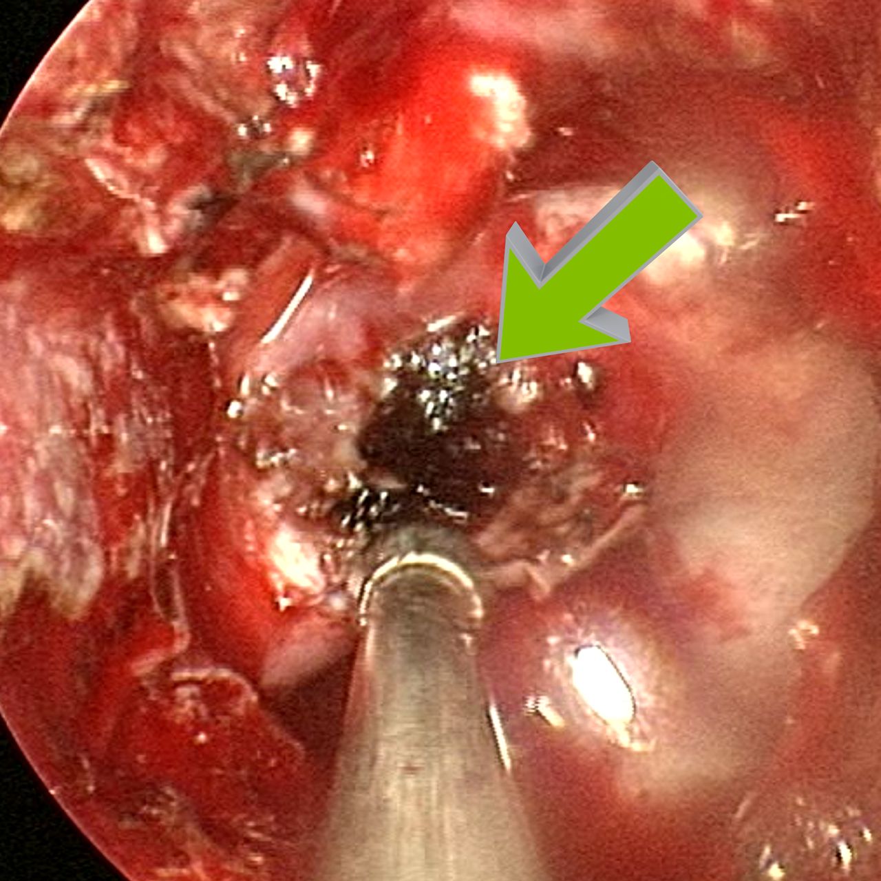 David Tafur Muñoz-1265