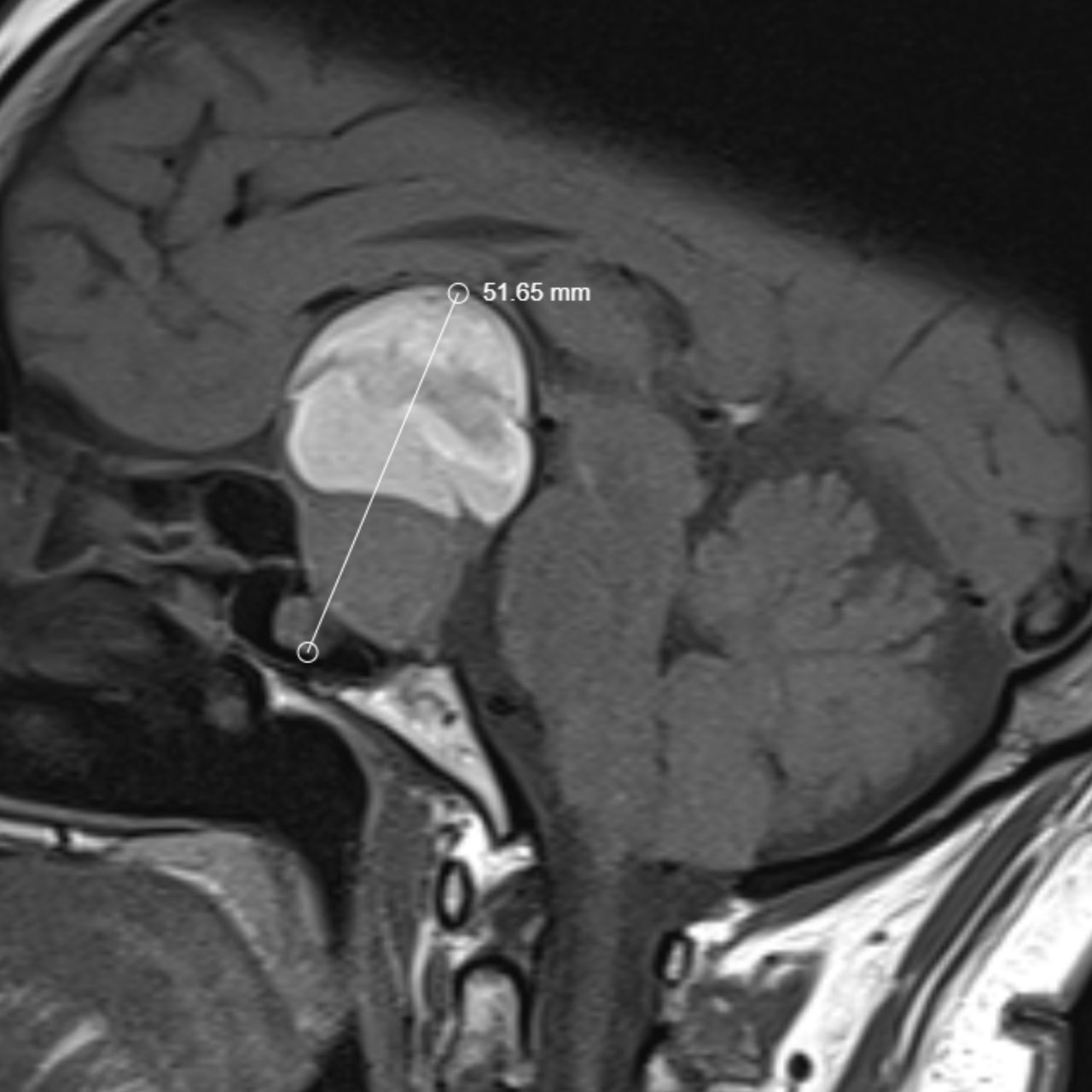 David Tafur Muñoz-1615