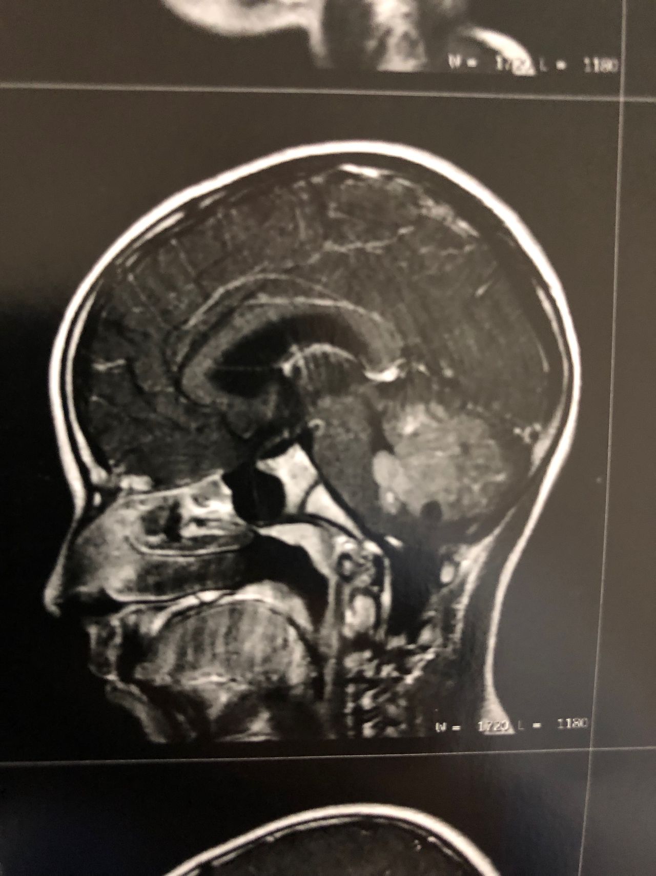 José Lopes Sousa Filho-34