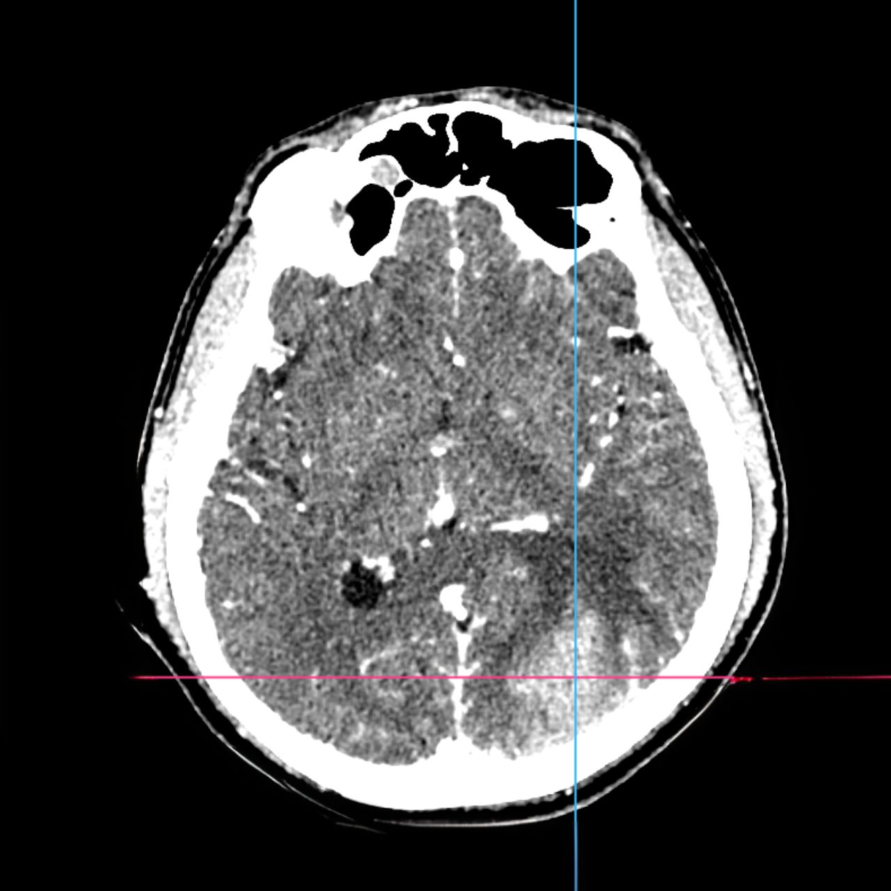 David Tafur Muñoz-1739