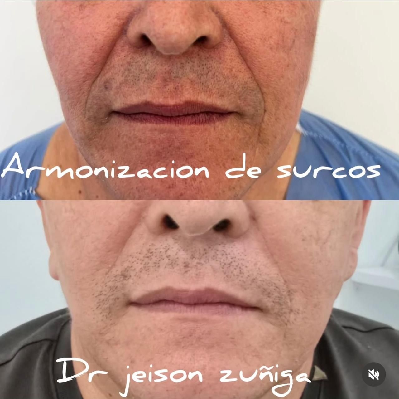 Jeison De Jesus Zuñiga Lara-4