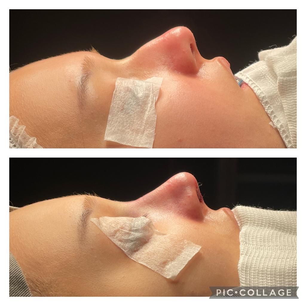 Luiz Henrique Chequim-4