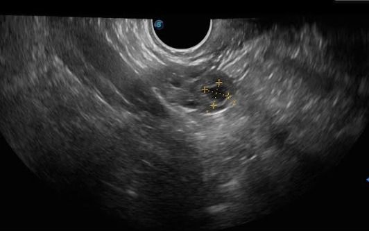 Arisev Maria Figueroa Ramos-6