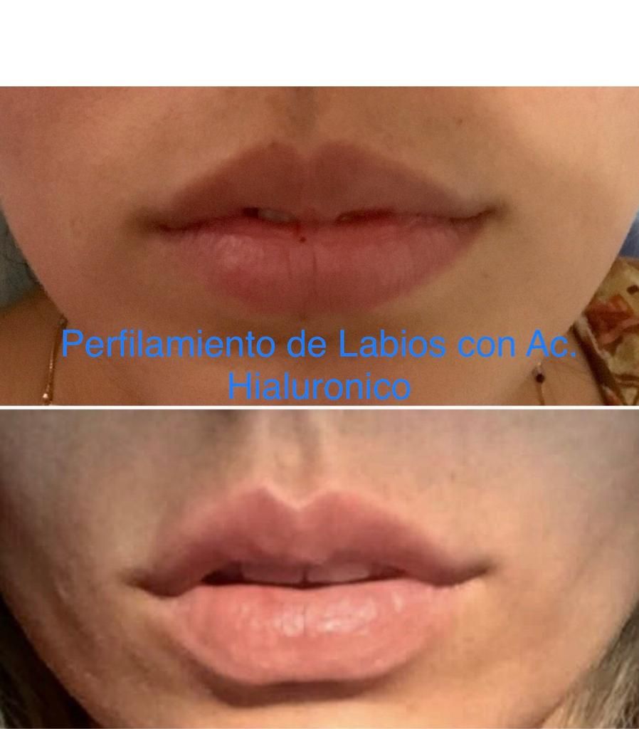 Maria Gisela Angel Losada-50