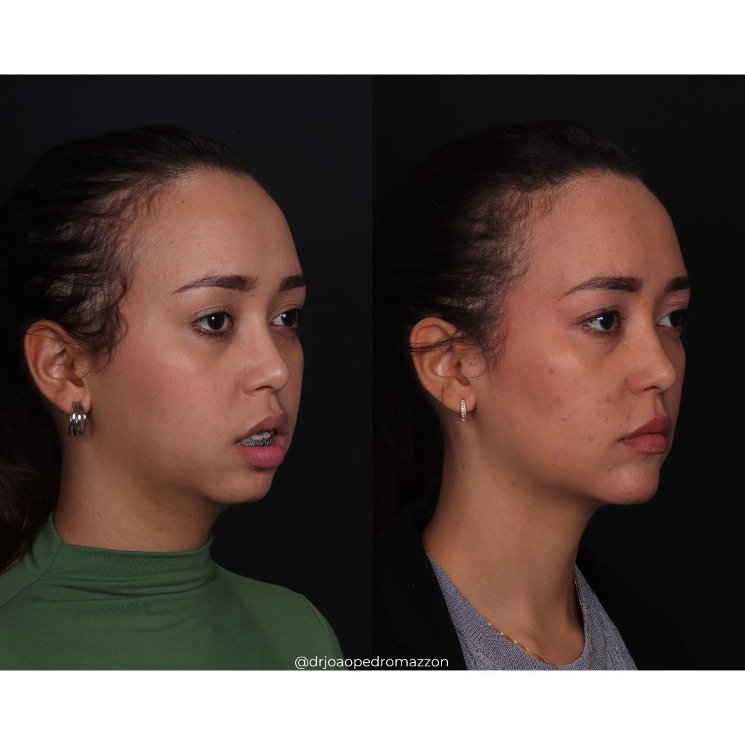 João Pedro Paulino Mazzon-37