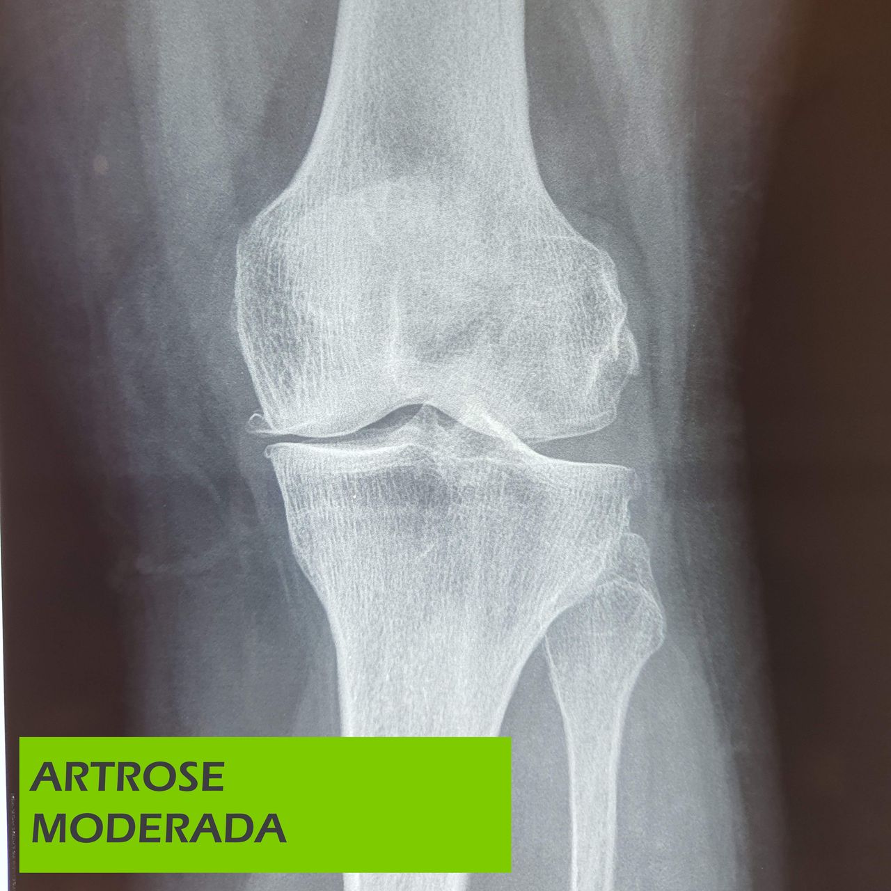 Paulo Roberto Capelletti-35