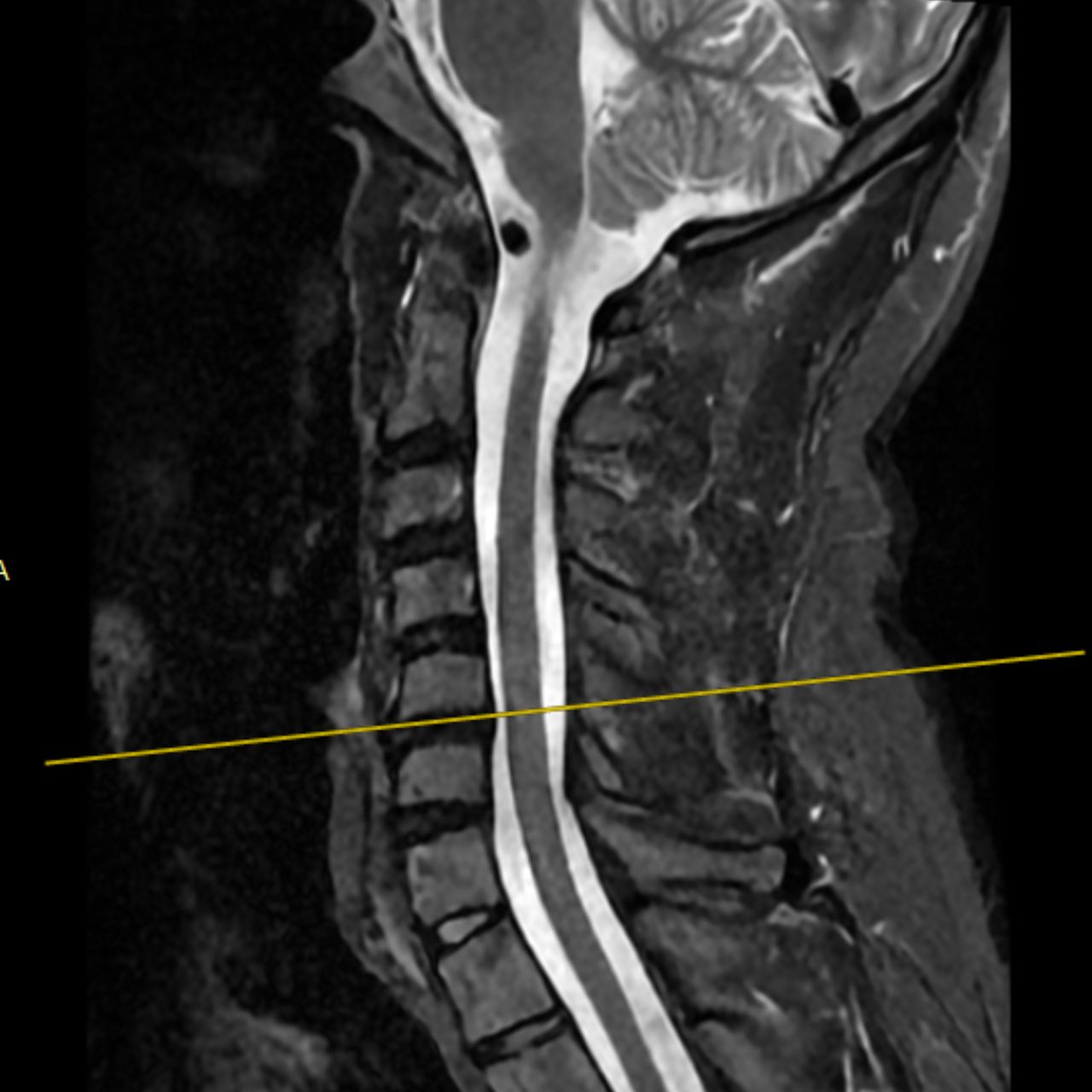 David Tafur Muñoz-1570