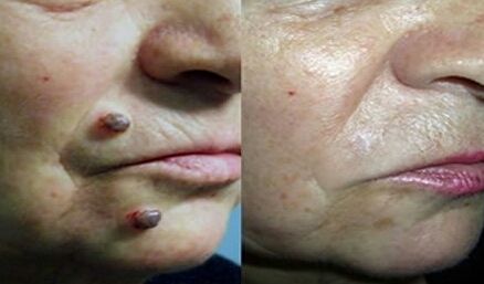 Julián Guerrero Almeida-35