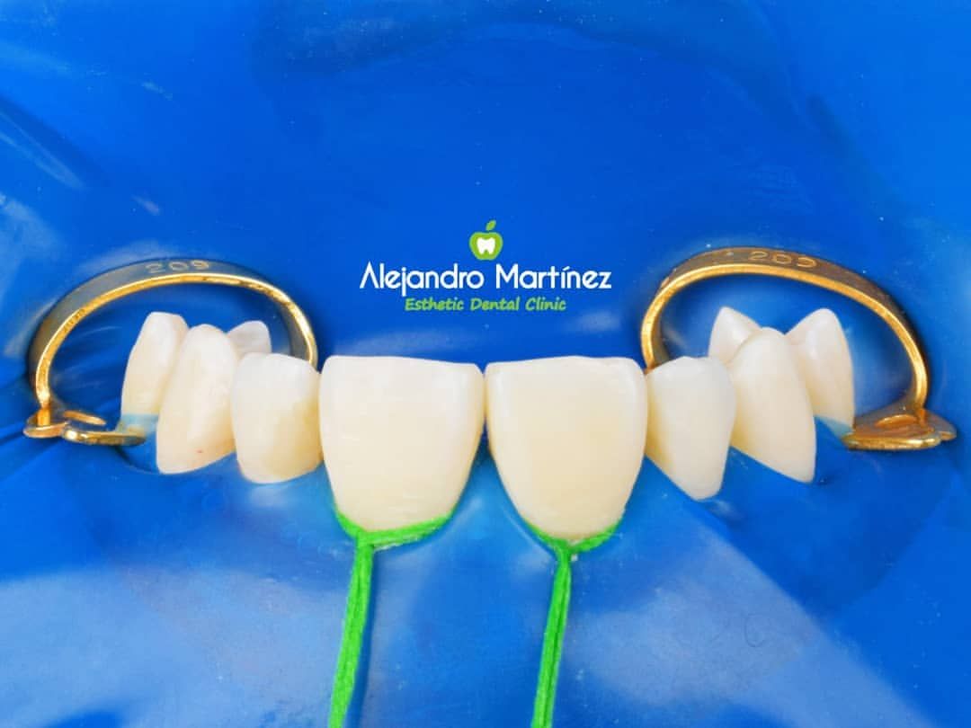 Alejandro Martinez-16