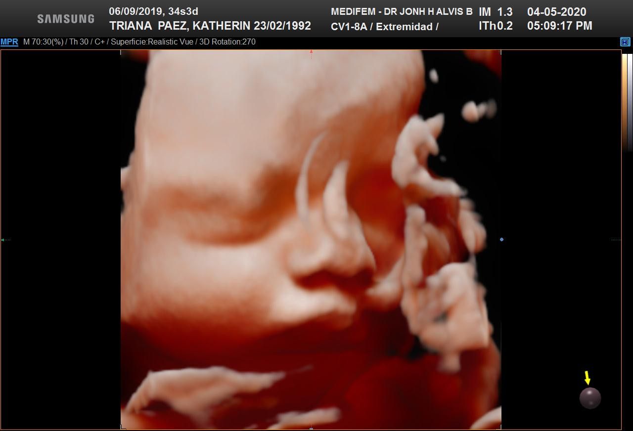 Jonh Harold Alvis Botello-23