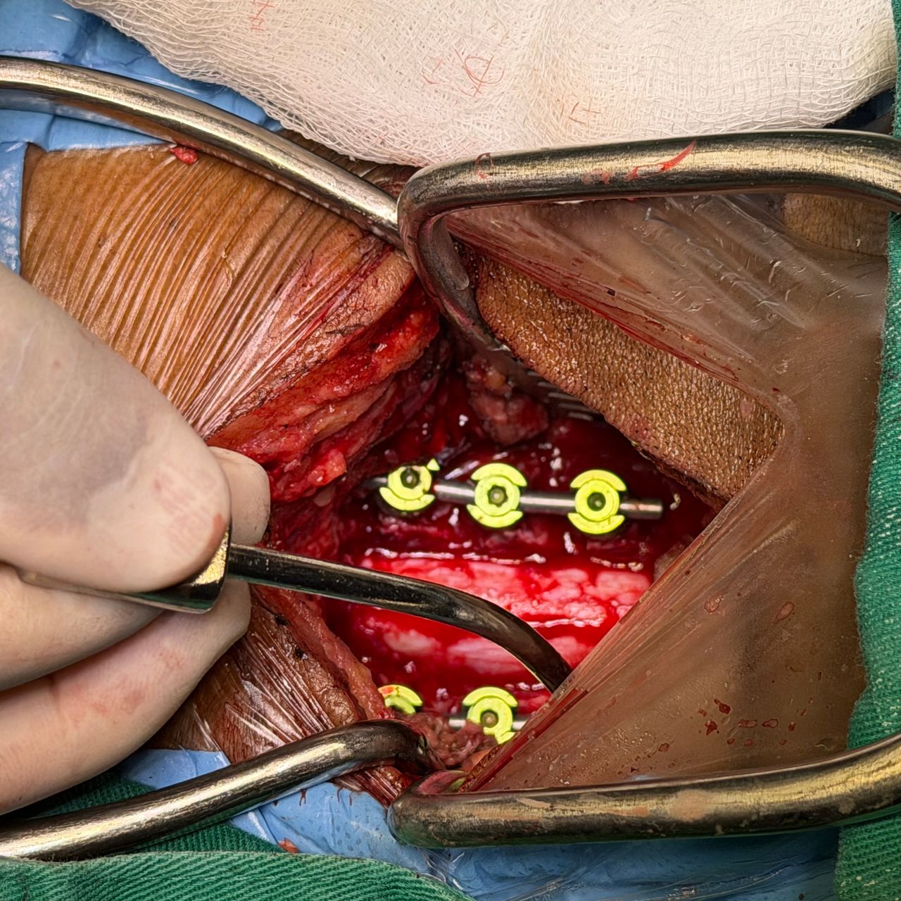 David Tafur Muñoz-2423