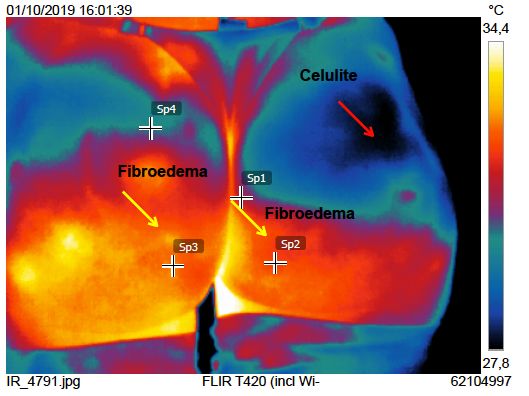 Diego Chiara Chaves-10