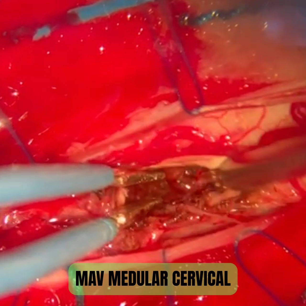 David Tafur Muñoz-1248