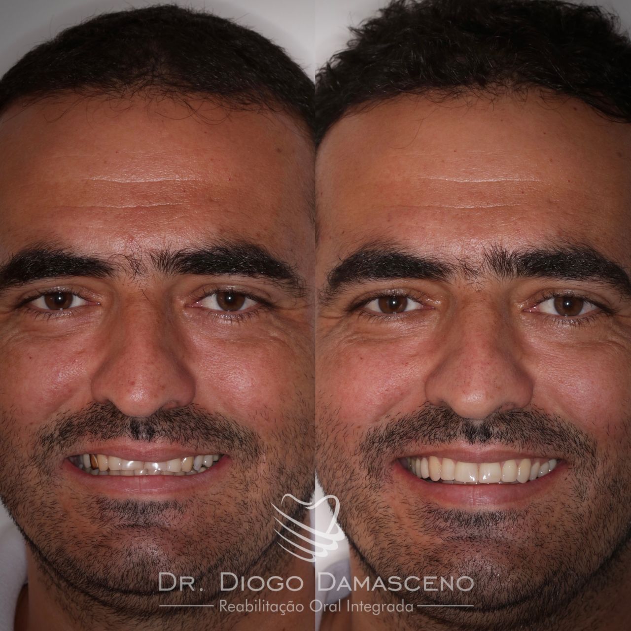Diogo Damasceno-7