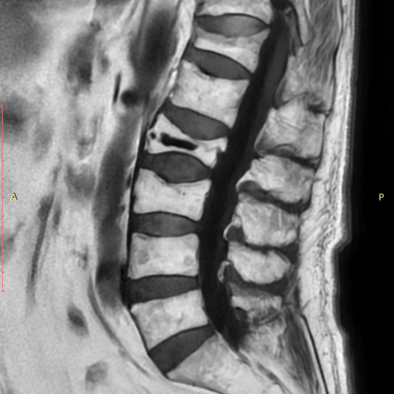 David Tafur Muñoz-1504