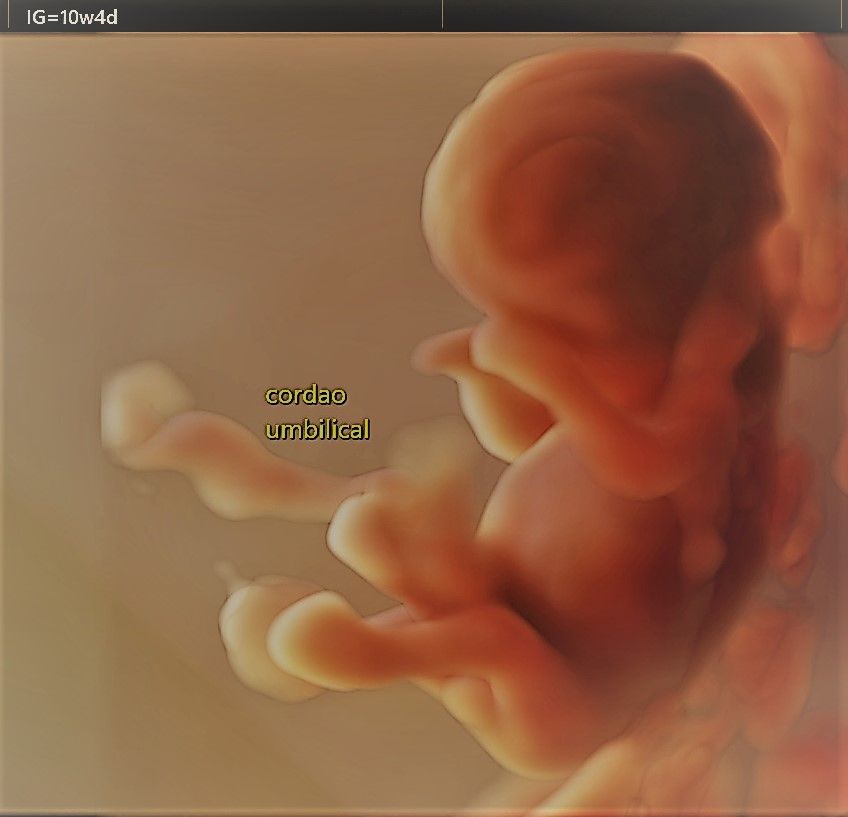 Charles Schwantz De Lima-30