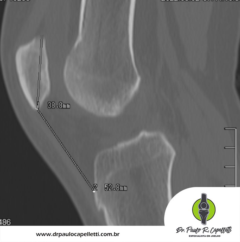 Paulo Roberto Capelletti-47