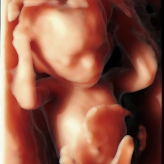 Charles Schwantz De Lima-27